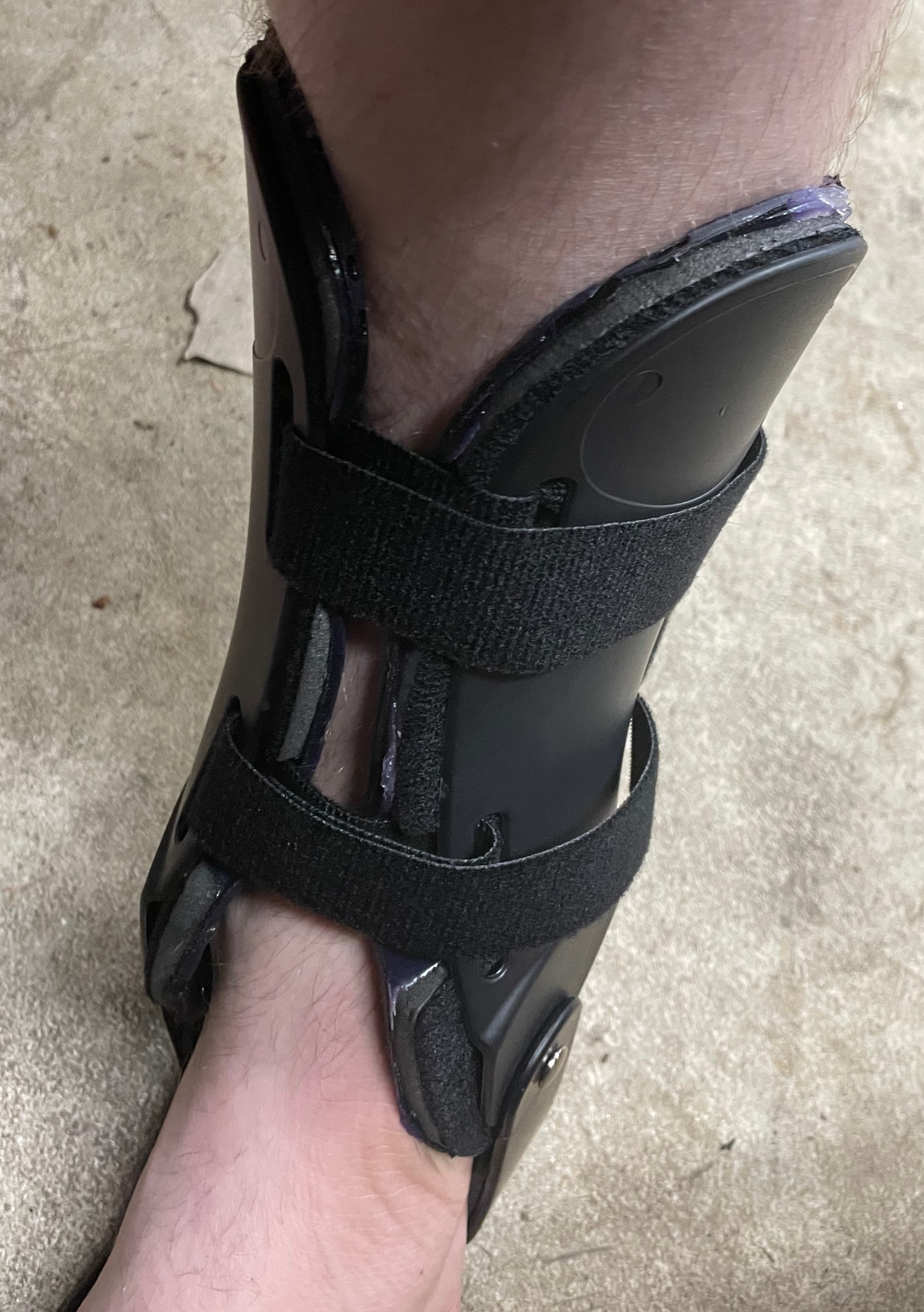 Comfort Ankle Offloading brace